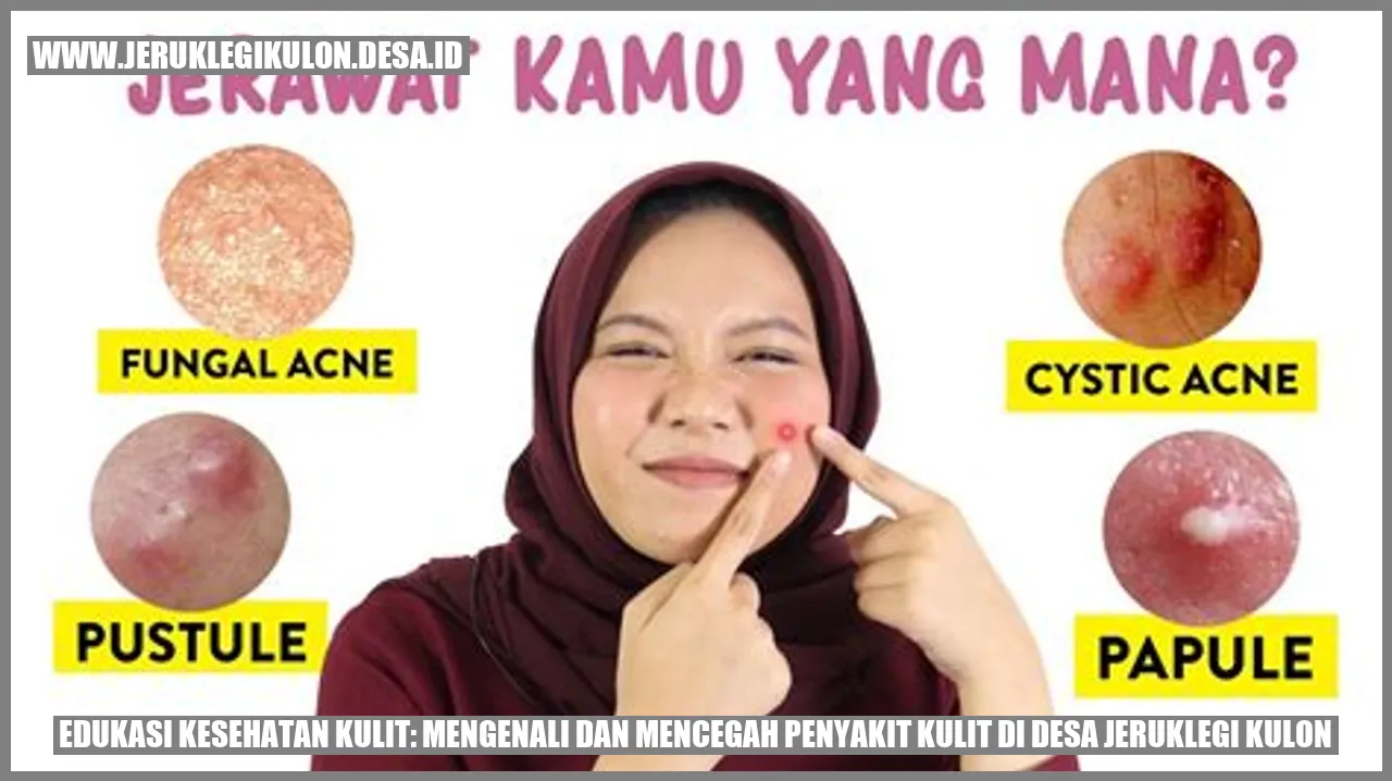Edukasi Kesehatan Kulit: Mengenali dan Mencegah Penyakit Kulit di Desa Jeruklegi Kulon