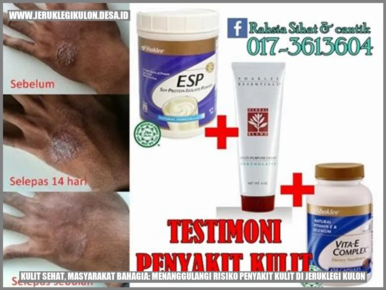 Kulit Sehat, Masyarakat Bahagia